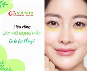 1-lay-mo-bong-mat-bac-si-vinh-khoa-tham-my-benh-vien-cho-ray