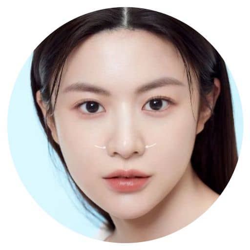 thu-gon-canh-mui-drvinh-khoa-tham-my-benh-vien-cho-ray