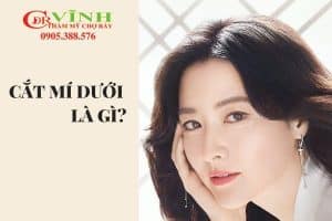 1-cat-mi-duoi-bac-si-vinh-khoa-tham-my-benh-vien-cho-ray