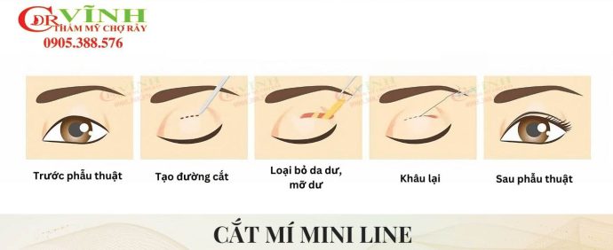 mo-ta-qua-trinh-cat-mi-mini-line