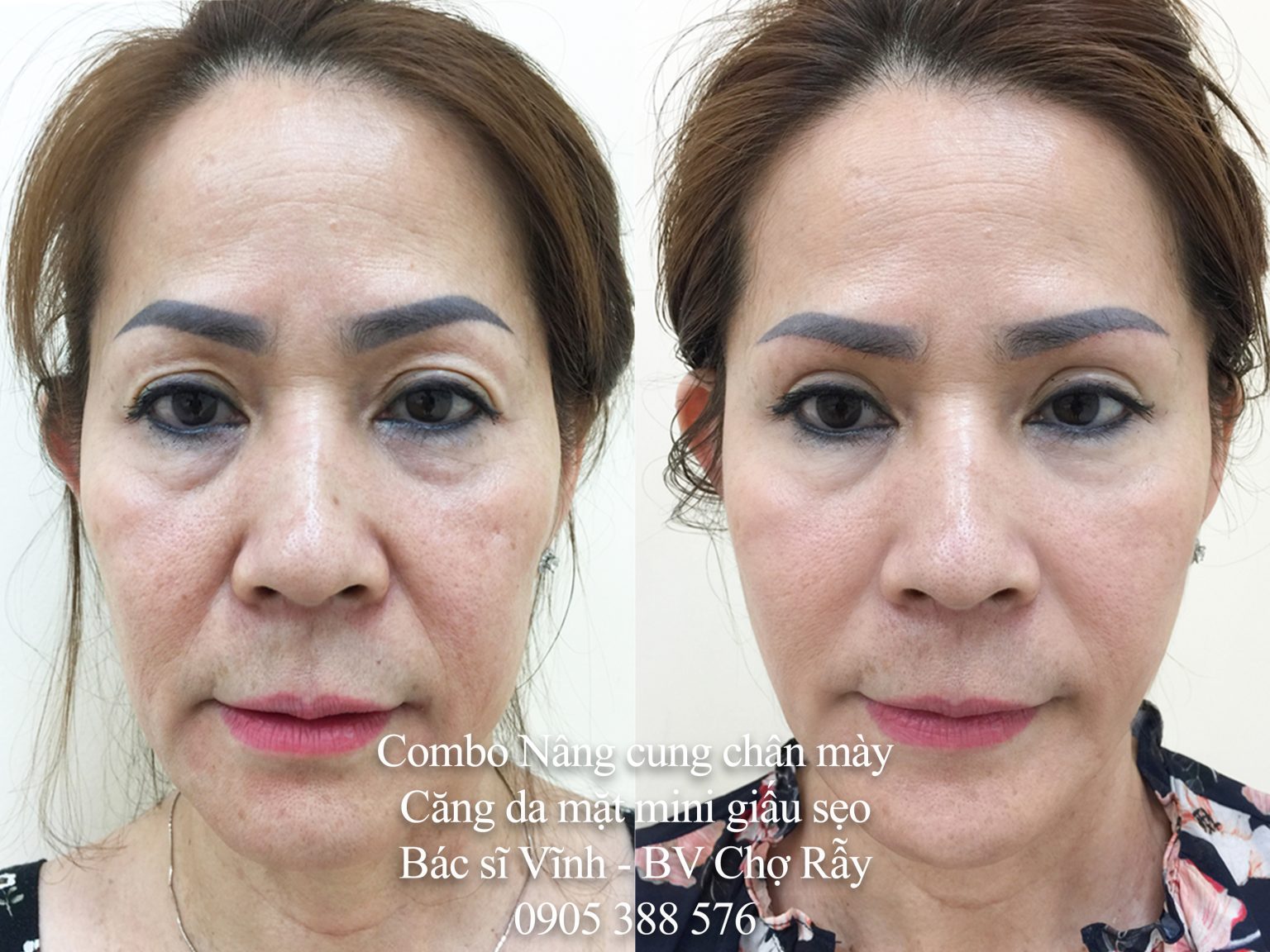 combo nang cung chan may cang da mat mini giau seo