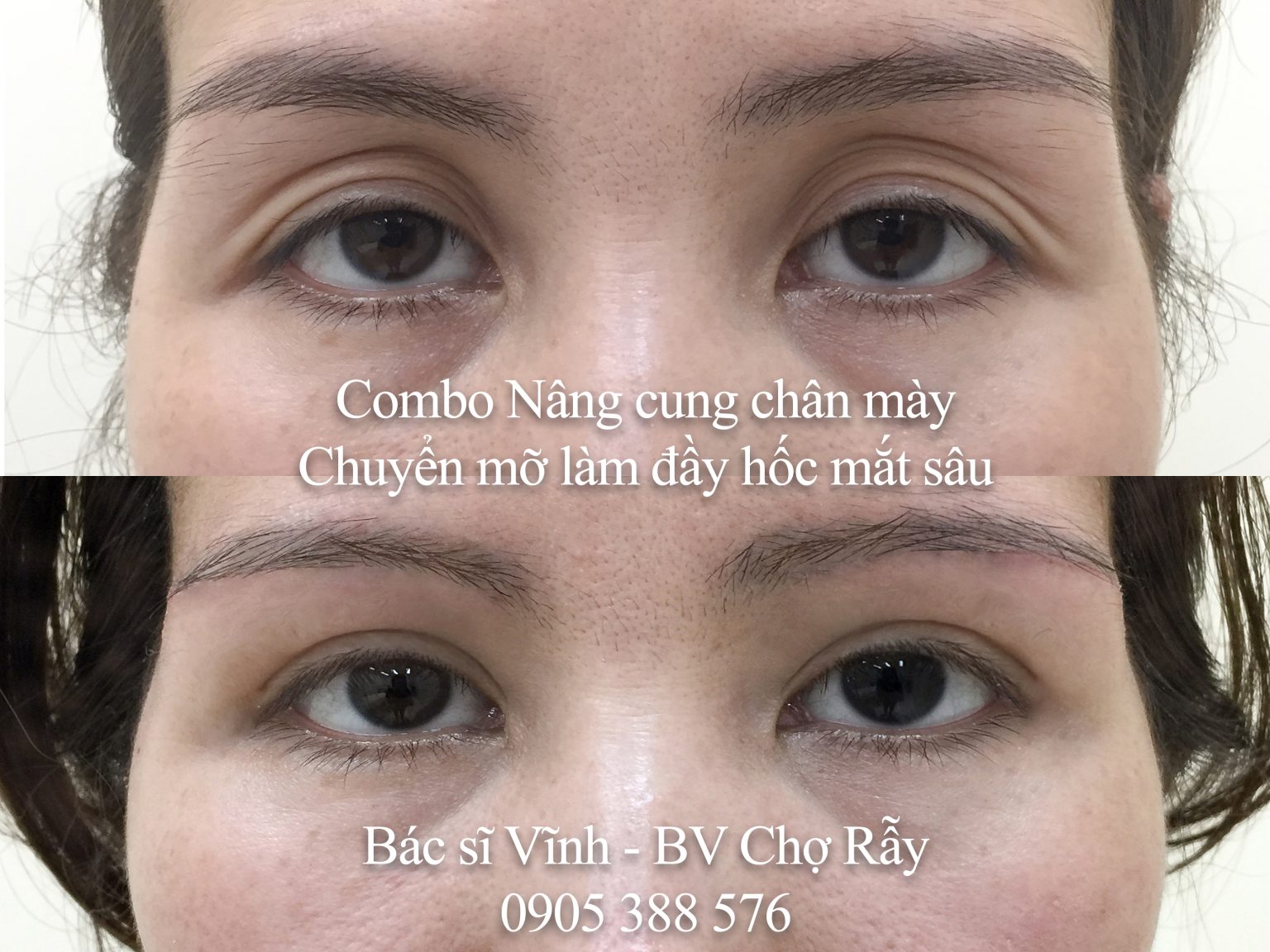 combo nang cung chan may chuyen mo lam day hoc mat sau