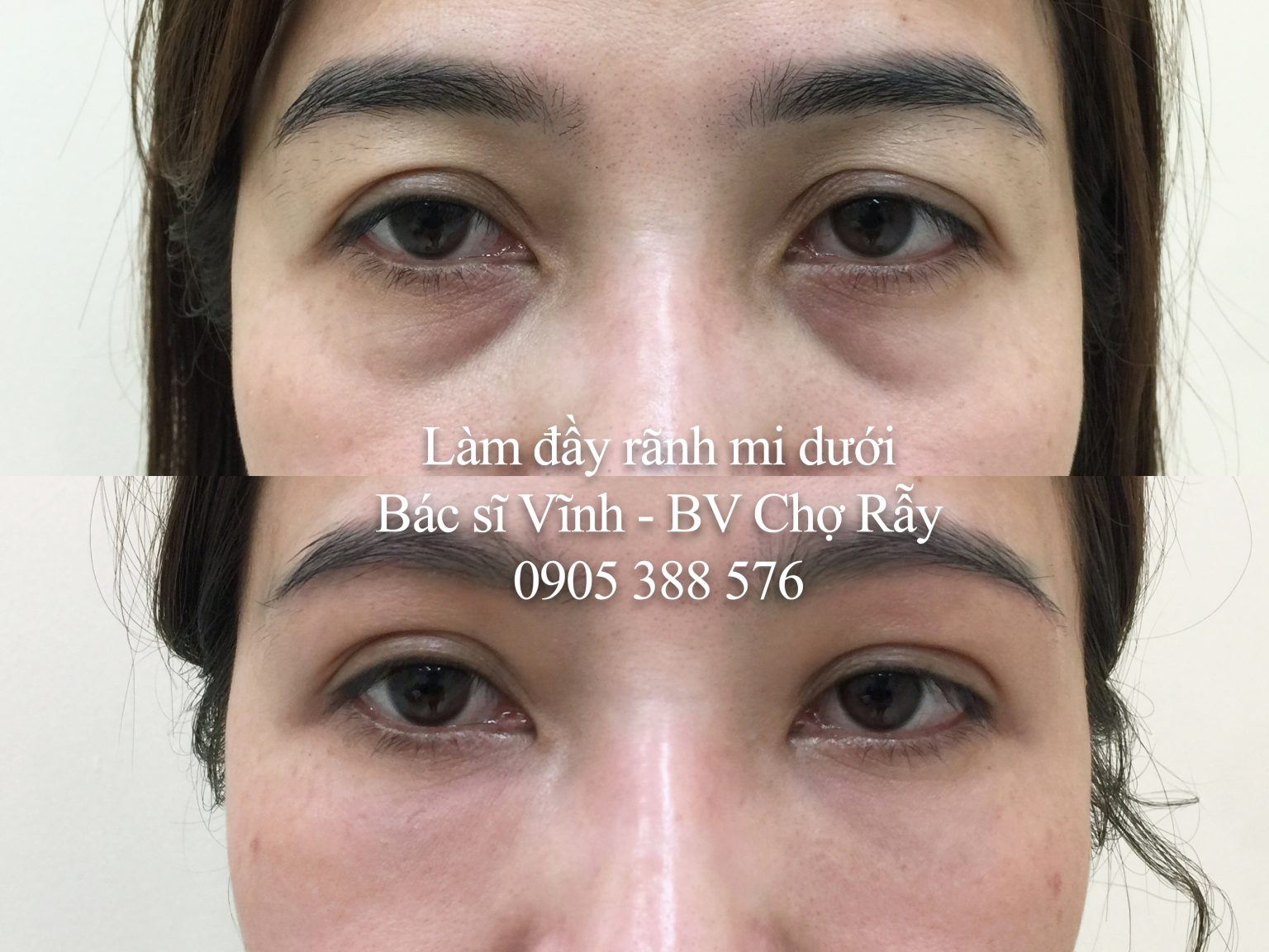 lam day ranh mi duoi