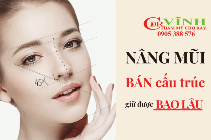 Nâng mũi bán cấu trúc giữ được bao lâu và những điều cần lưu ý