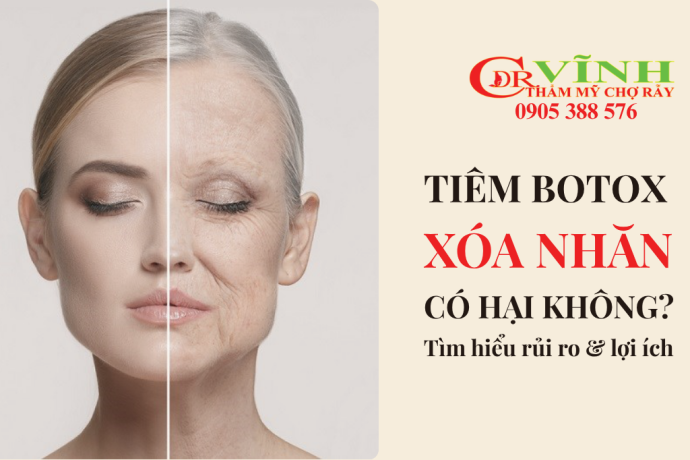 Tiêm botox xóa nhăn có hại không