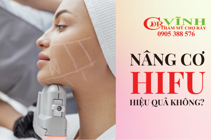 Nâng cơ hifu có hiệu quả không