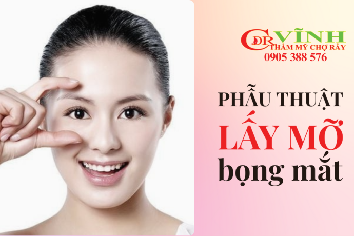 Phẫu thuật lấy mỡ bọng mắt trên, cập nhật giá và lưu ý quan trọng
