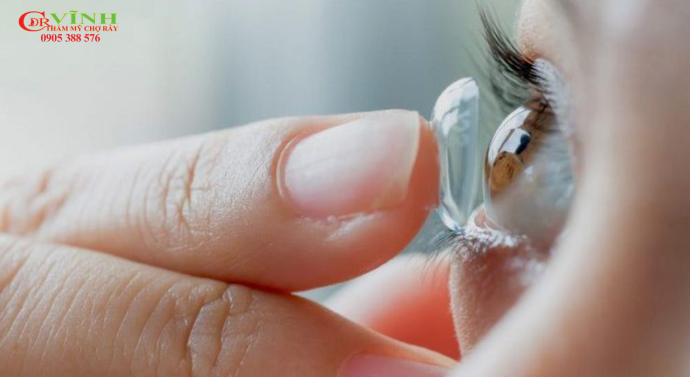 Nâng mũi bao lâu thì đeo kính được? Giải đáp chi tiết Phương án thay thế đeo kính sau khi nâng mũi