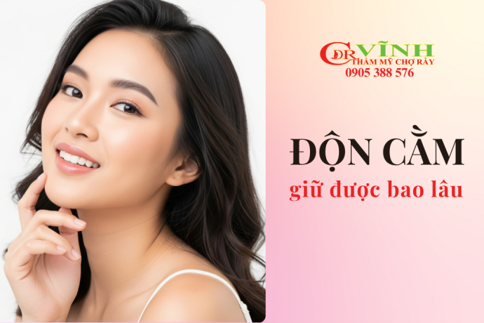 Độn cằm giữ được bao lâu