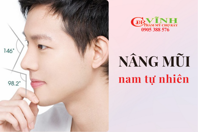 Nâng mũi nam tự nhiên và nâng mũi cao tây, nên chọn dáng mũi nào