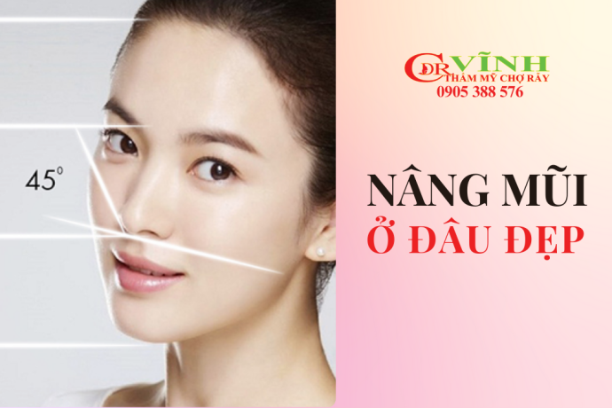 Nâng mũi ở đâu đẹp tại TP.HCM