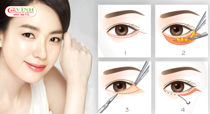 Tiêu chí để chọn bác sĩ thẩm mỹ mắt giỏi, uy tín Tiêu chí để chọn bác sĩ thẩm mỹ mắt giỏi - các dịch vụ thẩm mỹ mắt phổ biến