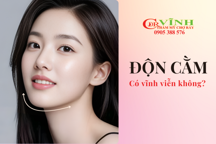 Độn cằm có được vĩnh viễn không