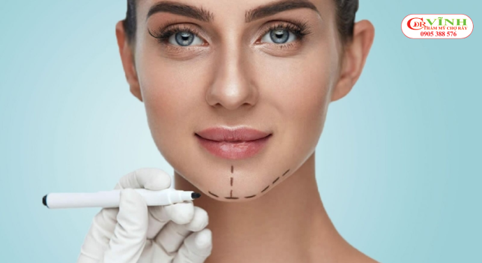 Độn cằm có được vĩnh viễn không - hiểu đúng về khái niệm