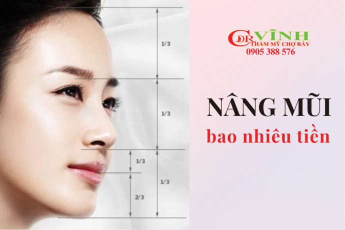 Nâng mũi hết bao nhiêu tiền? Bảng giá nâng mũi mới nhất