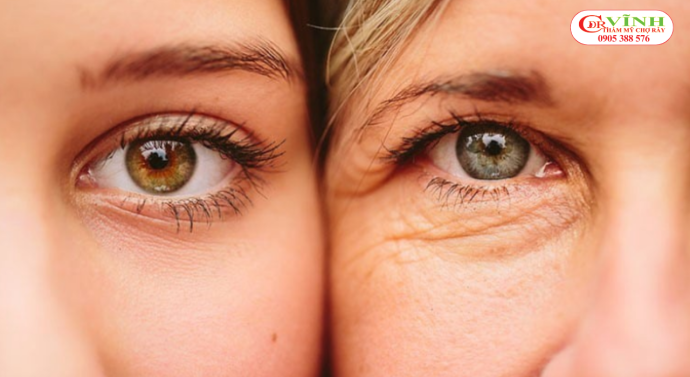 Tiêu chí để chọn bác sĩ thẩm mỹ mắt giỏi, uy tín Tiêu chí chọn bác sĩ thẩm mỹ mắt giỏi -thẩm mỹ mắt là gì