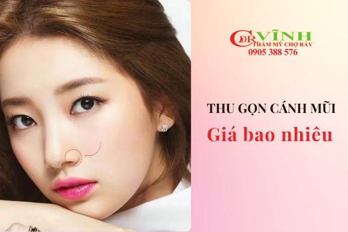 Thu gọn cánh mũi giá bao nhiêu tiền? Ở đâu uy tín