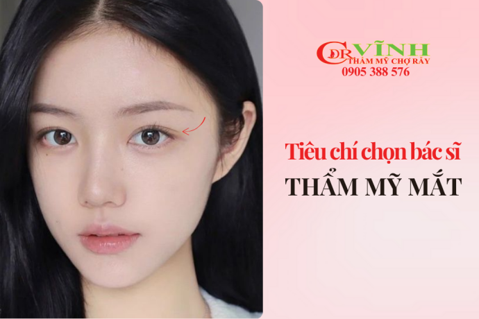 Tiêu chí để chọn bác sĩ thẩm mỹ mắt giỏi, uy tín