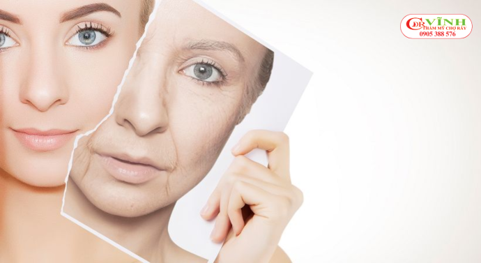 Ai nên thực hiện thẩm mỹ căng da mặt