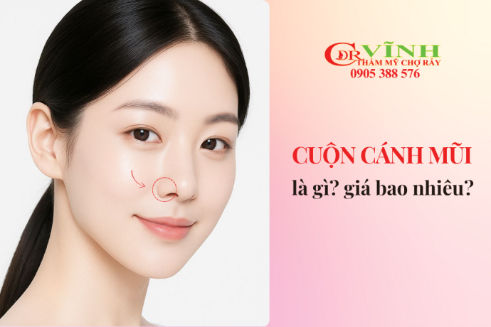 Cuộn cánh mũi là gì? Giá bao nhiêu có đau không?