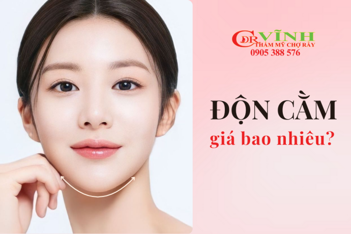 Độn cằm giá bao nhiêu