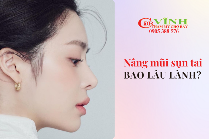 Nâng mũi sụn tai bao lâu thì lành và đẹp tự nhiên