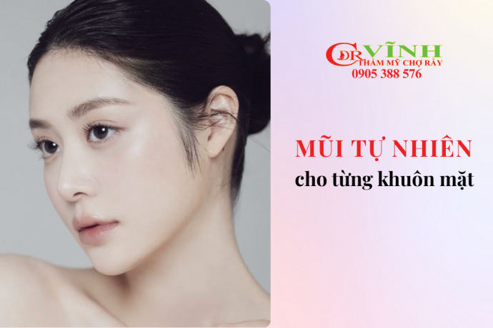 Dáng mũi tự nhiên cho từng gương mặt