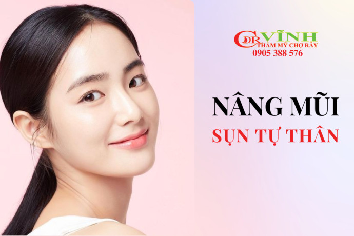 Nâng mũi sụn tự thân có phải tự nhiên nhất?