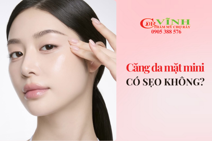 Căng da mặt mini có để lại sẹo không