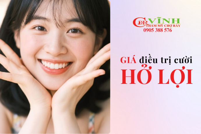 Điều trị cười hở lợi giá bao nhiêu