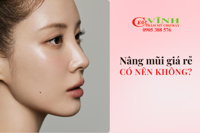 Có nên nâng mũi giá rẻ không
