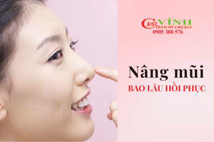 Nâng mũi bao lâu thì sinh hoạt bình thường và quy trình hồi phục chuẩn y khoa
