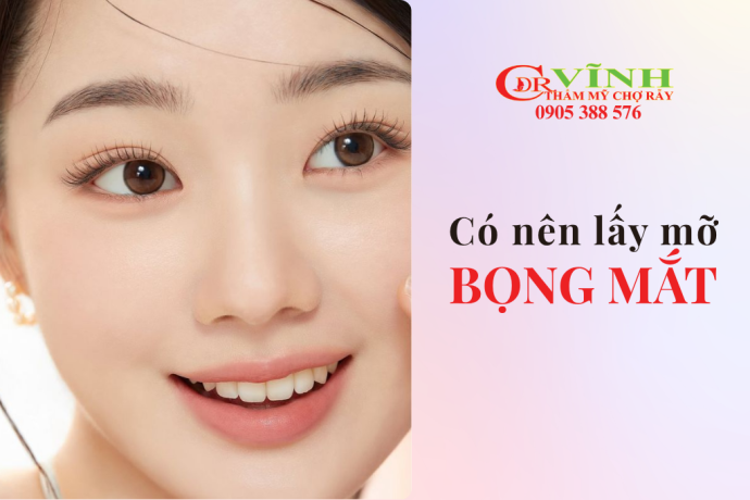 Có nên lấy mỡ bọng mắt không? Ai nên và không nên làm?
