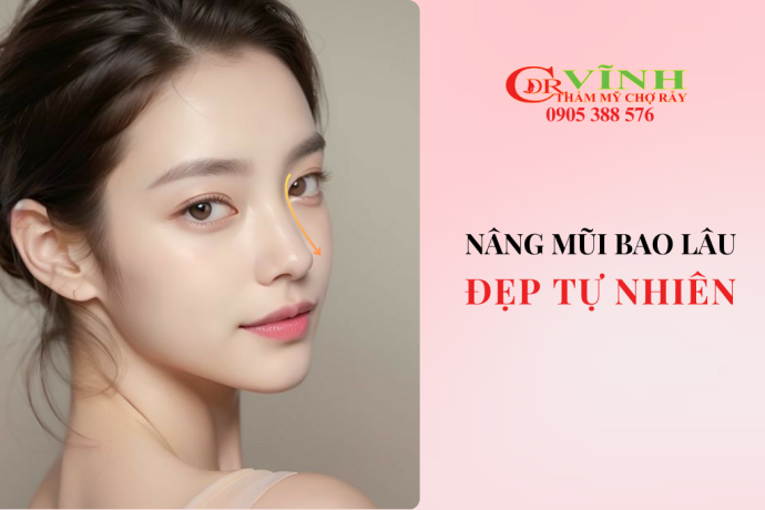Nâng mũi bao lâu thì đẹp tự nhiên? Bác sĩ giải đáp chi tiết