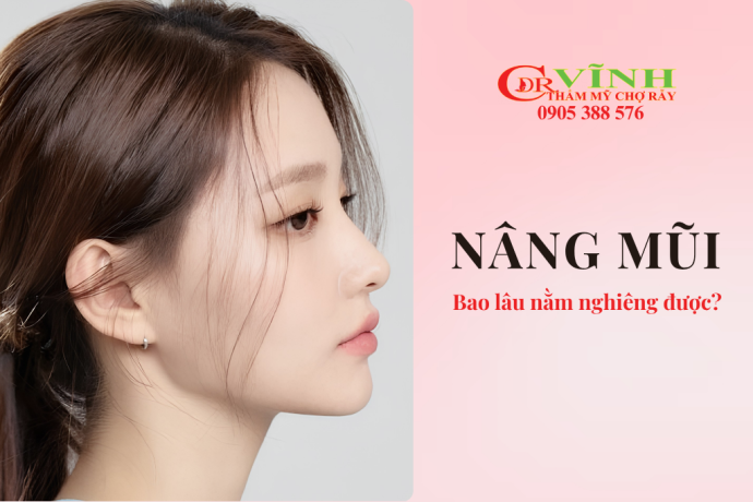 Nâng mũi bao lâu thì được nằm nghiêng