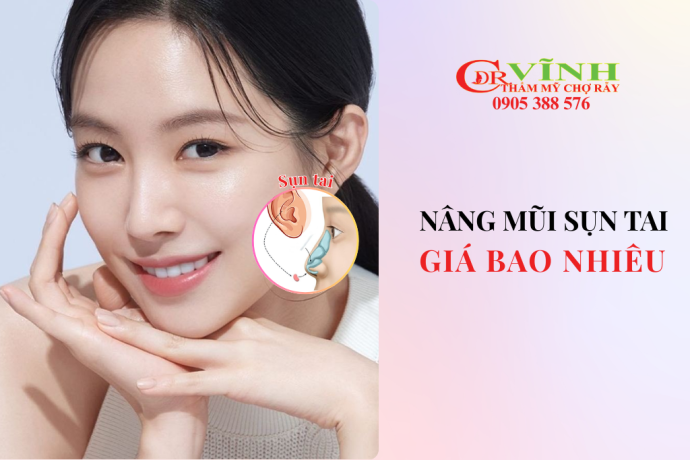 Nâng mũi sụn tai giá bao nhiêu
