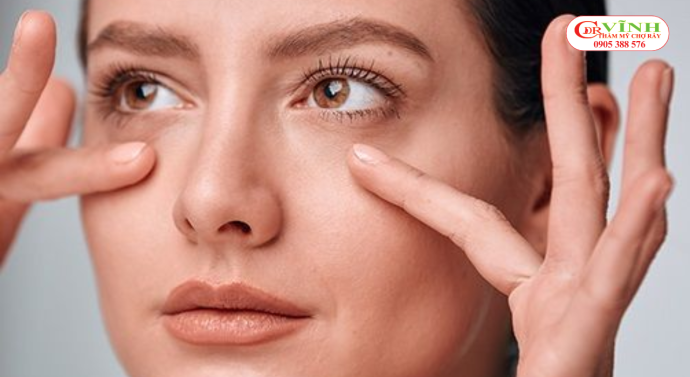 Những yếu tố cần cân nhắc trước khi quyết định lấy mỡ bọng mắt