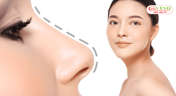 Mô phỏng dáng mũi sau nâng khi mũi dần ổn định và vào form tự nhiên