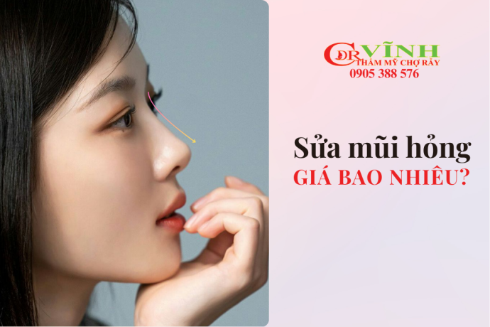 Sửa mũi hỏng giá bao nhiêu? Liệu có đắt hay không?