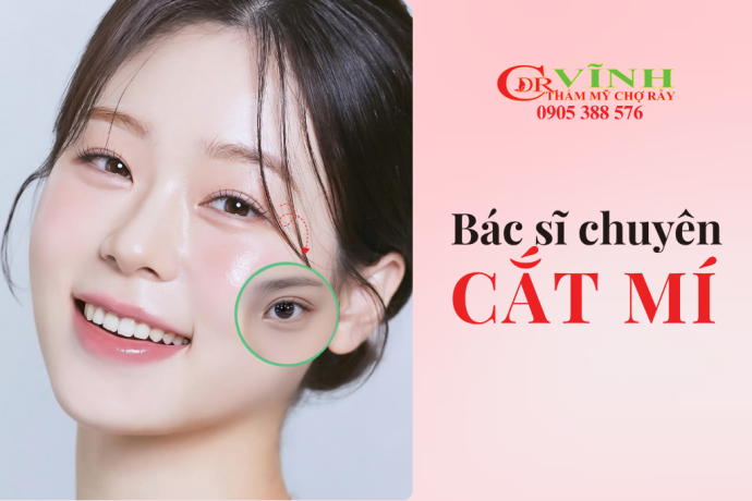 Bác sĩ cắt mí đẹp ở TP HCM - Bác sĩ chuyên cắt mí mắt