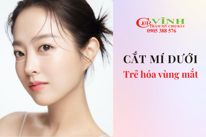 Cắt mí dưới trẻ hóa vùng mắt hiệu quả