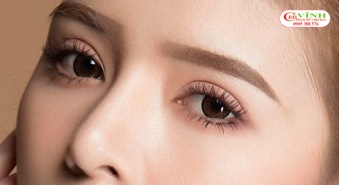 Nếp mí mắt tự nhiên sau cắt mí với đường mí cân đối và hài hòa khuôn mặt