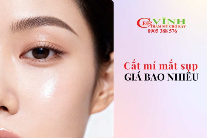 Cắt mí mắt bị sụp giá bao nhiêu
