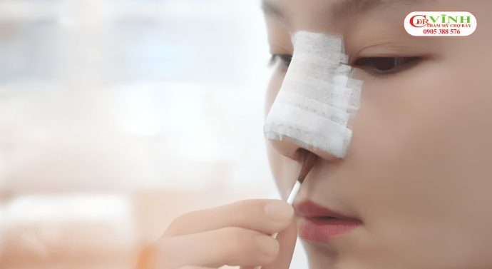 Chăm sóc sau nâng mũi đúng cách giúp vết mổ nhanh lành và hạn chế nguy cơ để lại sẹo.