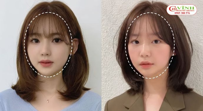 Khuôn mặt tròn thường có tỷ lệ chiều dài và chiều rộng gần bằng nhau.