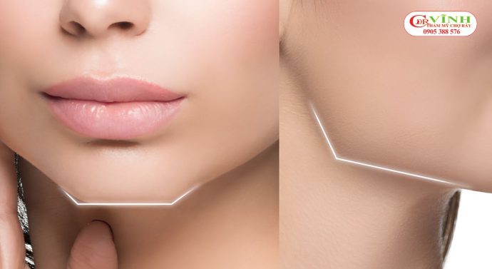 Mặt vuông thường có đường nét góc cạnh và mạnh mẽ hơn