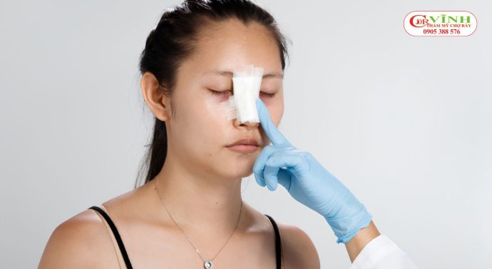 Nâng mũi có bị sẹo hay không phụ thuộc vào nhiều yếu tố, trong đó quan trọng nhất là tay nghề bác sĩ và quá trình hồi phục của mỗi người.