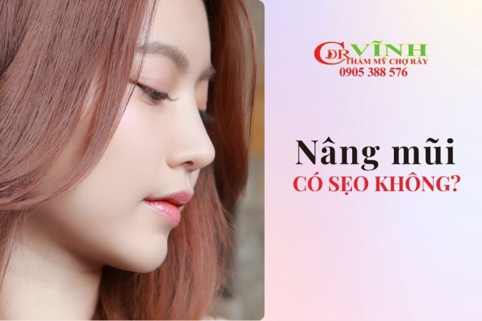 Nâng mũi có để lại sẹo không? Cách hạn chế sẹo sau phẫu thuật