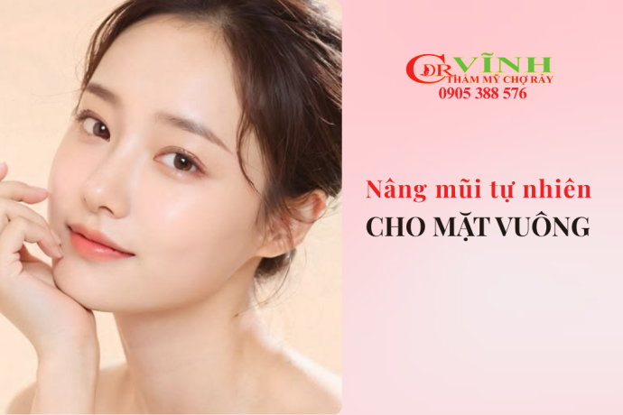 Nâng mũi tự nhiên cho mặt vuông: 4 tiêu chí giúp gương mặt hài hòa hơn