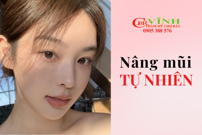 Nâng mũi tự nhiên là gì? Bí quyết sở hữu dáng mũi hài hòa và lâu dài